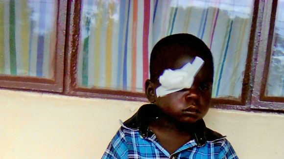 Zonobia sits alone after treatment for trachoma.