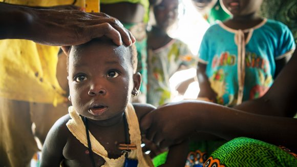 Aminata has her eyes screened for trachoma.