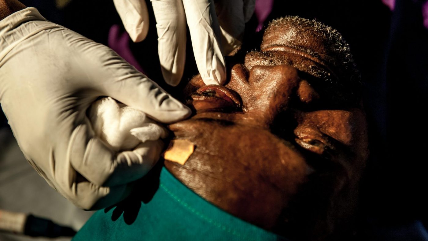 Winesis operation.