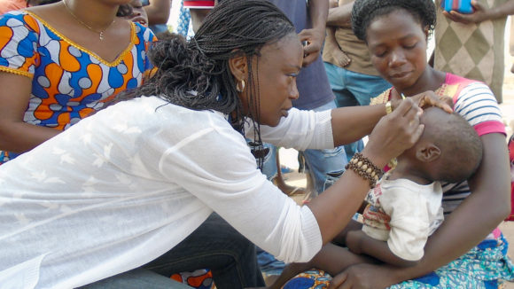 Ett barn i Elfenbenskusten får sina ögon undersökta för trakom.