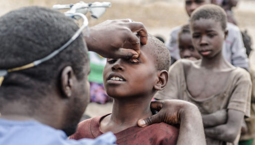 Ögonkirurgen Dr Ndalela undersöker ögonen på ett barn för att leta efter tecken på trakom.